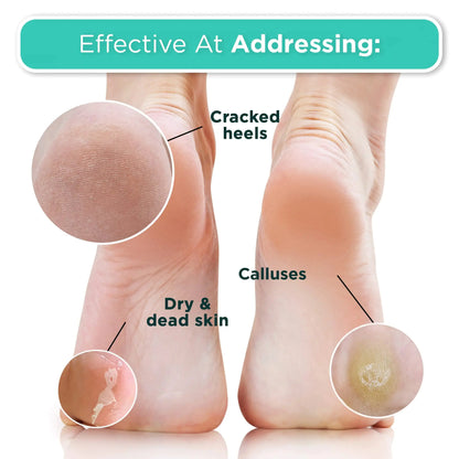 DERMORA Foot Peel Mask – 2 Pack French Lavender Exfoliating Foot Masks for Soft, Smooth Feet